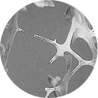 Obraz mikroskopowy kości osteoporotycznej